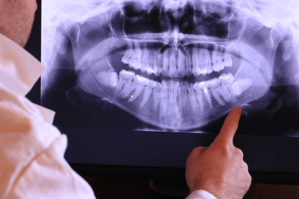 Best Mobile Emergency Dentist in Monroe, OH