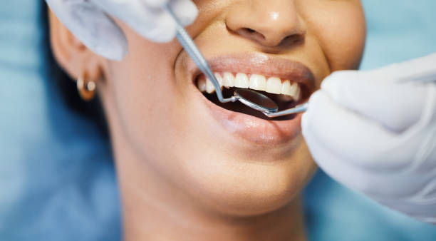 Best Broken or Cracked Tooth Emergency Dentist in Monroe, OH